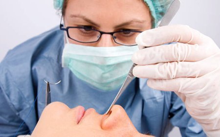 Balance and Dizziness Post Rhinoplasty Vestibular Exercises