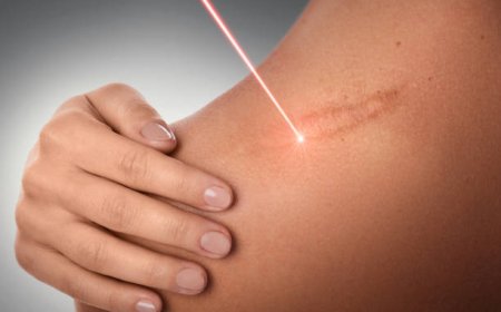 Laser Scar Removal with LED: Light Therapy Synergy Boost