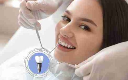 The Role of Micro-Movements in Healing Zirconia Dental Implants