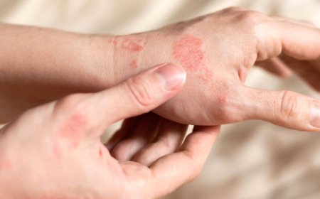 Generic Cipro works at fast Pace Against Bacteria’s