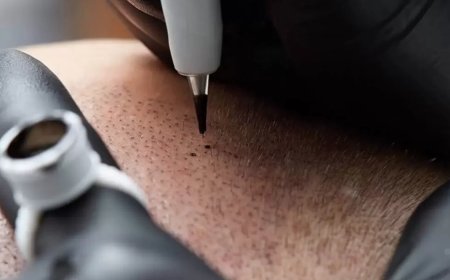 What Is a Hair Tattoo for Hair Loss and How Does It Work?