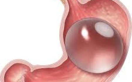 How safe is a gastric balloon for people with heart conditions?