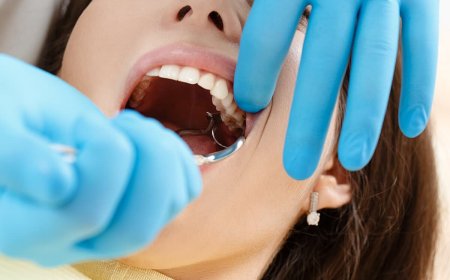 What to Know About Dental Extraction Costs and Nearby Care