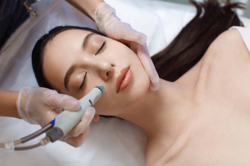 Hydrafacial Procedure Explained: Steps for Deep Cleansing