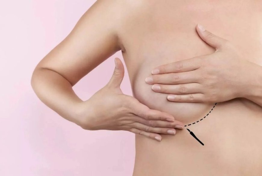 Breast Lift in Dubai – Expert Insights and Guidance