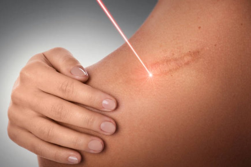 Laser Scar Removal with LED: Light Therapy Synergy Boost