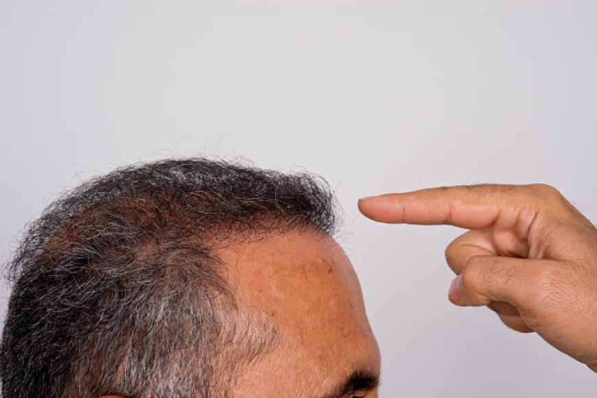 Hair Transplant Aftercare: Scalp Washing Without Damage Tips