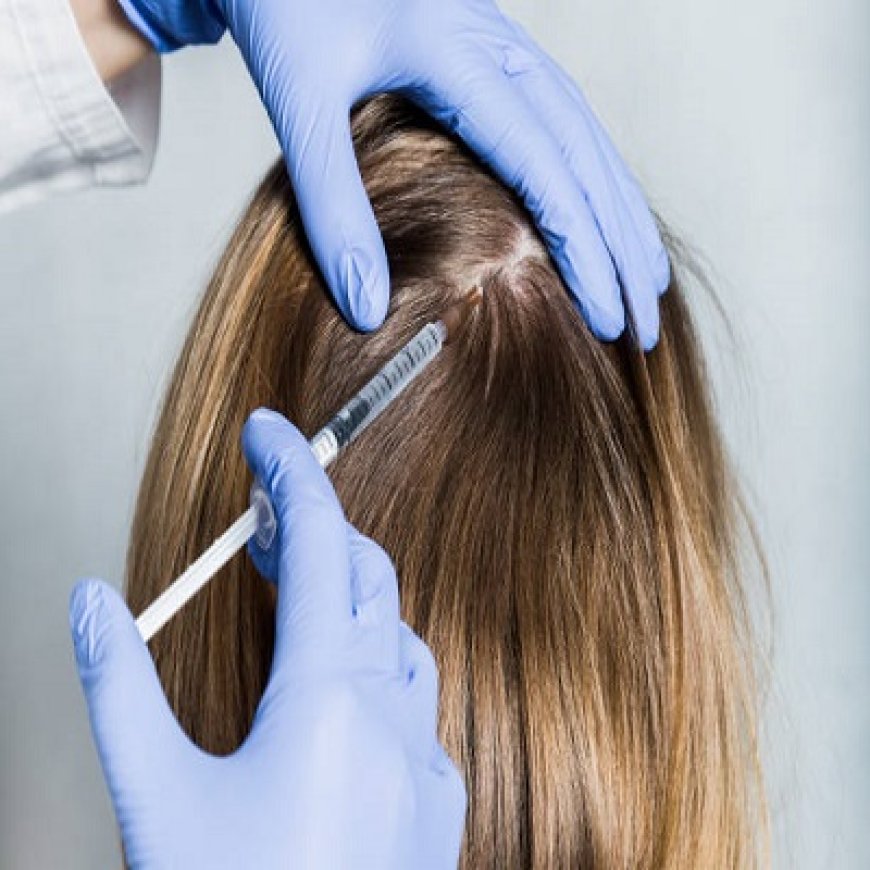 What Is PRP Hair Treatment and How Does It Work in Riyadh?