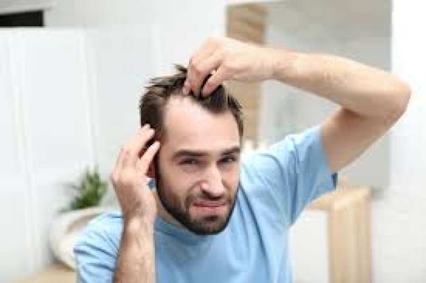 Save Money on Hair Loss Treatment with Generic Propecia