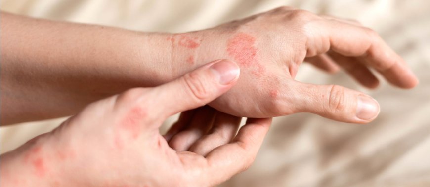 Generic Cipro works at fast Pace Against Bacteria’s