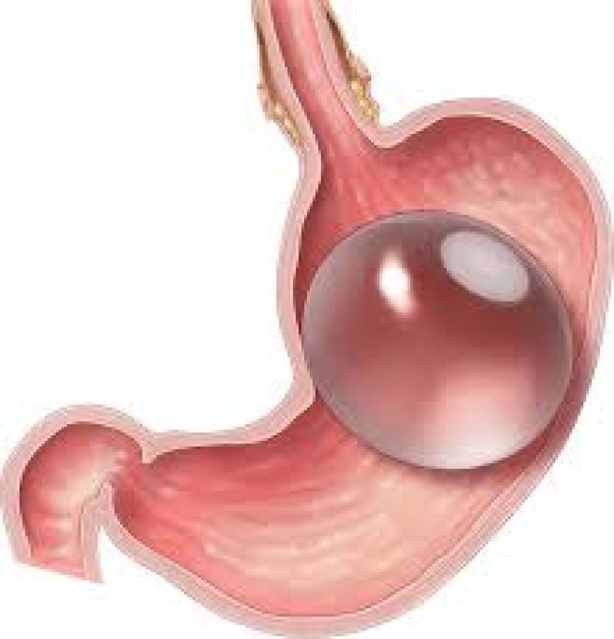 How safe is a gastric balloon for people with heart conditions?