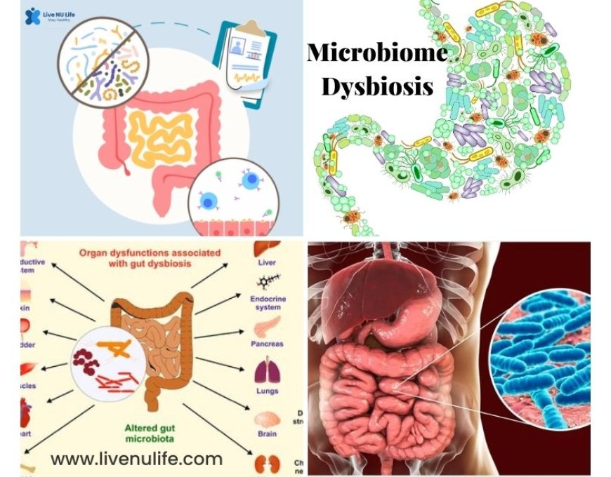 Microbiome Dysbiosis