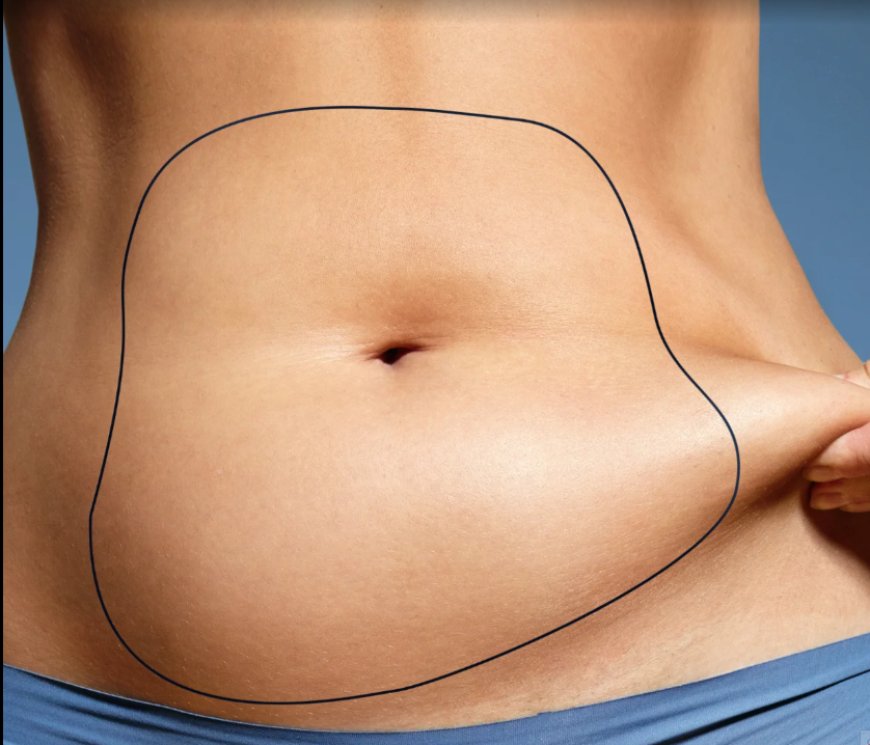 Feel Confident Again with Liposculpture in Dubai