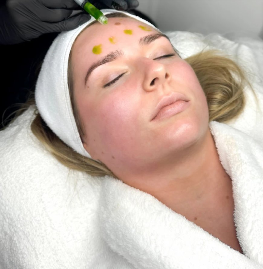 Get Long-Lasting Volume with Sculptra in Manchester