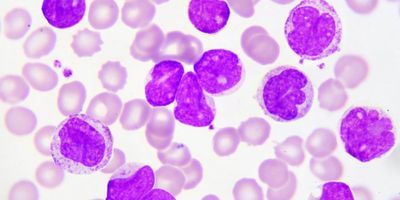 AML Treatment Pharma Pioneers of 2023 Revealed